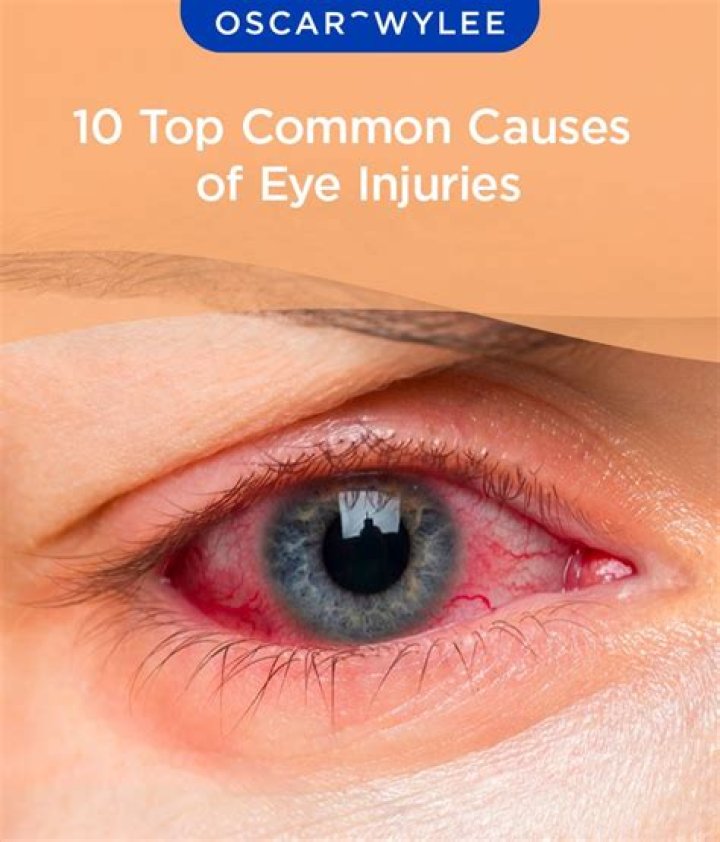 Anthony Zerbe Eye Injury: A Comprehensive Analysis and Updates