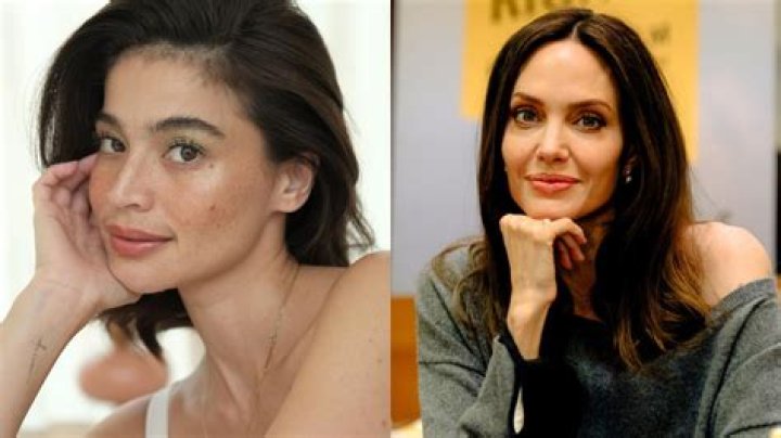 Celebrities with Moles: Embracing Natural Beauty and Individuality