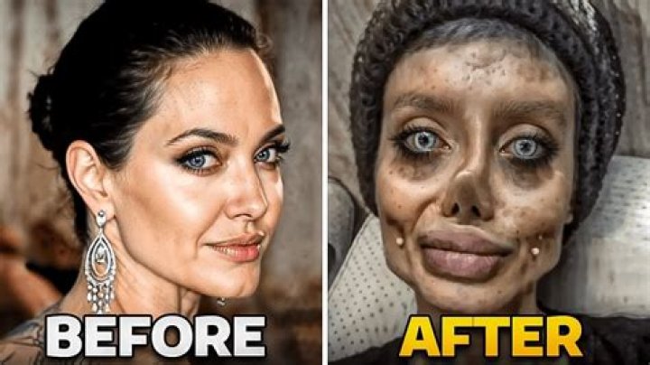 Heidi Montag's Transformation: Before and After Plastic Surgery