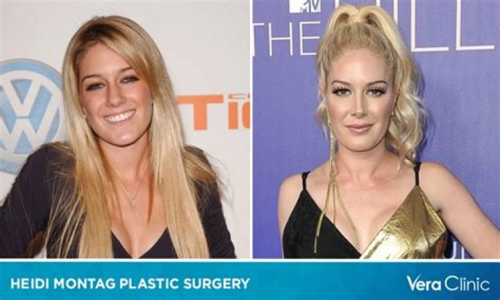 Heidi Montag Before Surgery: A Glimpse Into Her Past