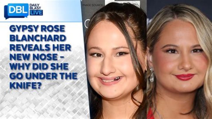 How Many Surgeries Did Gypsy Blanchard Have? A Comprehensive Analysis