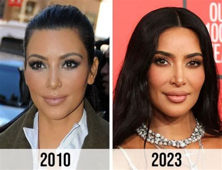Kim Kardashian's Plastic Surgery Journey: A Comprehensive Guide