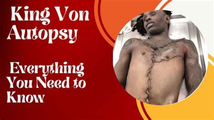 King Bon Autopsy: Unveiling the Truth Behind the Controversy